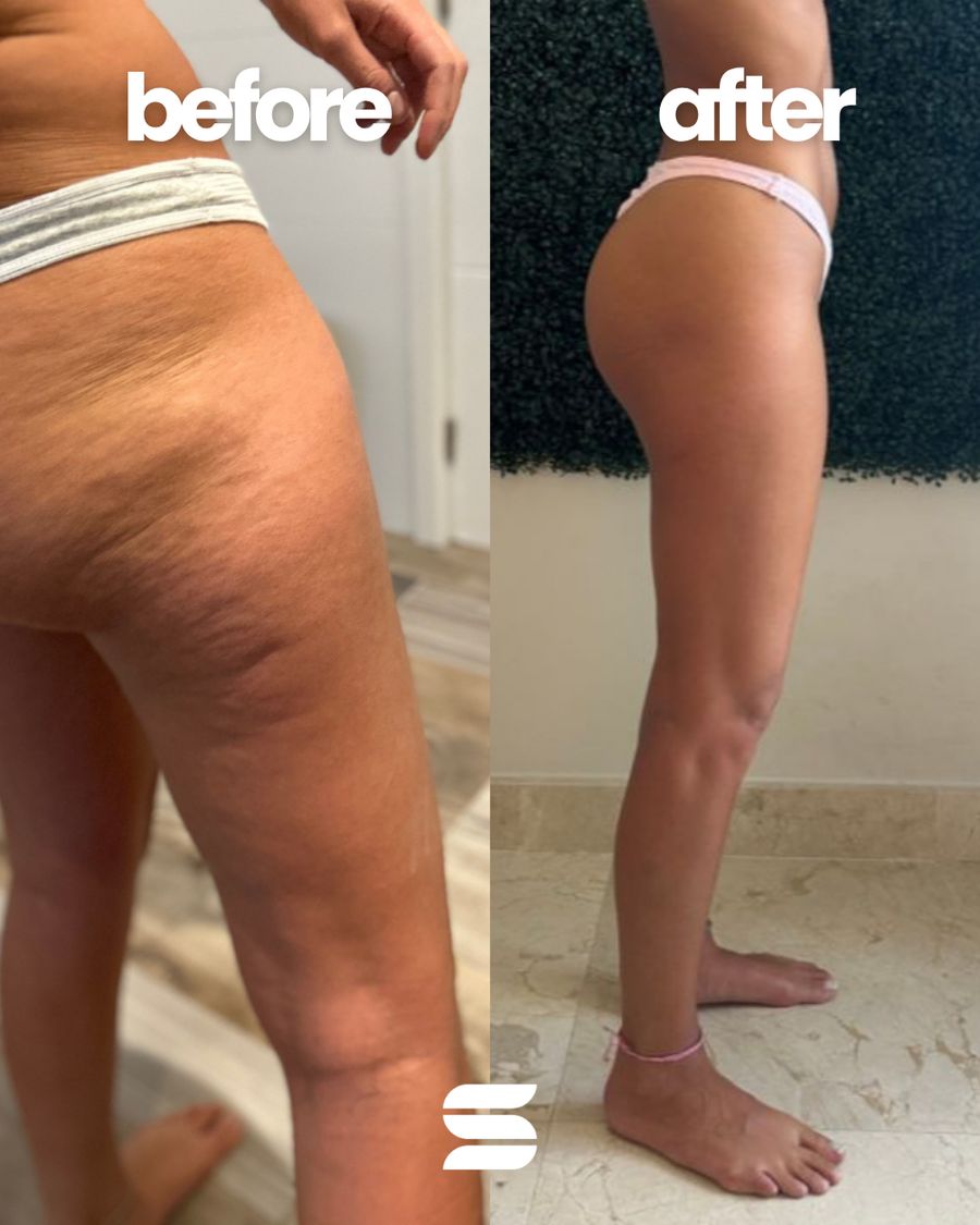 SWEATNGLOW client before and after transformation 1